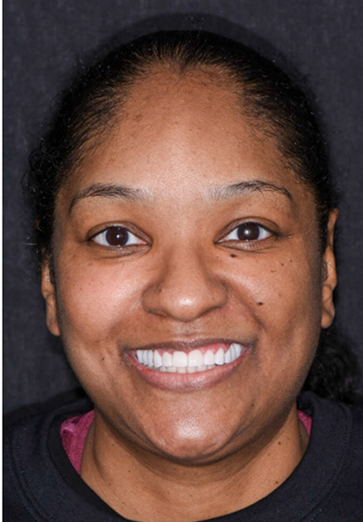 Patient with gorgeous smile after cosmetic dentistry