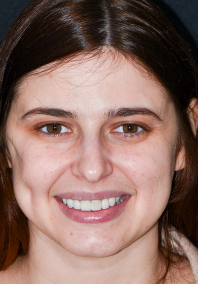 Patient with gorgeous smile after cosmetic dentistry