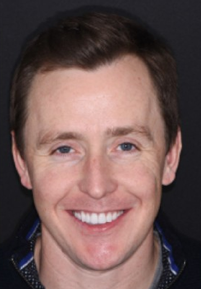 Patient with gorgeous smile after cosmetic dentistry