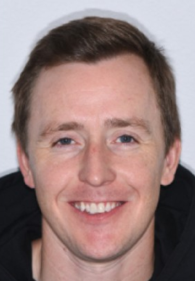 Patient with imperfect smile before cosmetic dentistry