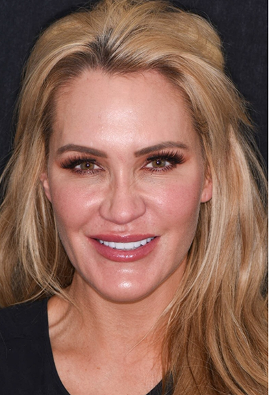 Patient with gorgeous smile after cosmetic dentistry