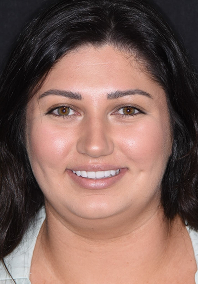 Patient with gorgeous smile after cosmetic dentistry