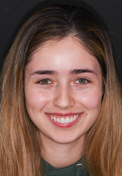 Patient with gorgeous smile after cosmetic dentistry