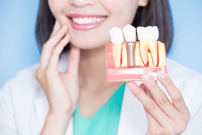 a person holding a model of a dental implant