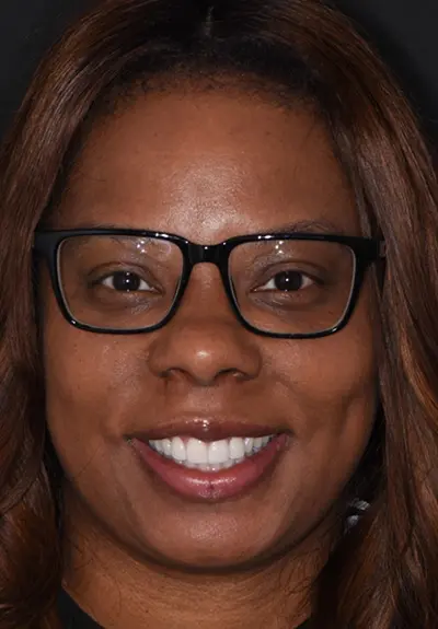 closeup of perfect smile after cosmetic dentistry