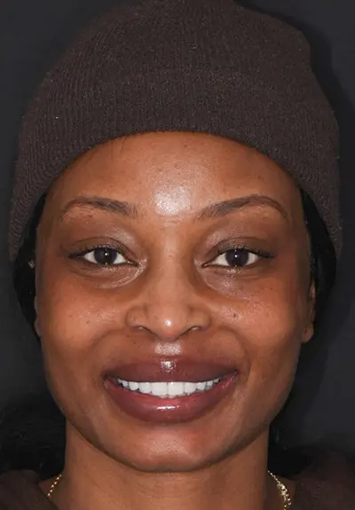 closeup of perfect smile after cosmetic dentistry
