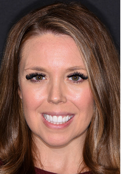 Patient with gorgeous smile after cosmetic dentistry