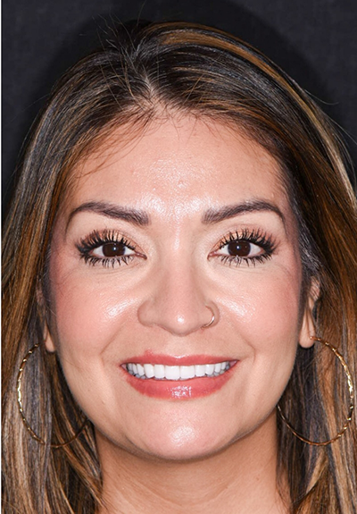 Patient with gorgeous smile after cosmetic dentistry