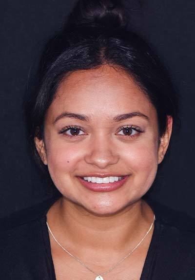 Woman with perfectly aligned smile after clear braces orthodontics