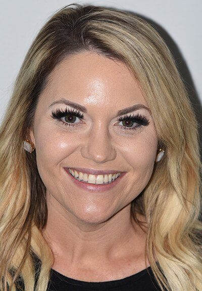 Patient with imperfect smile before cosmetic dentistry