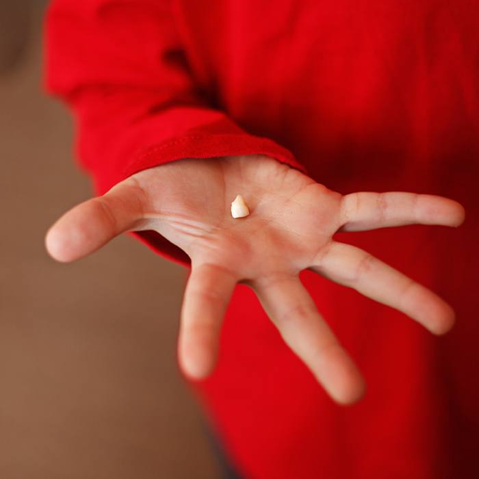 Hand holding a knocked out tooth