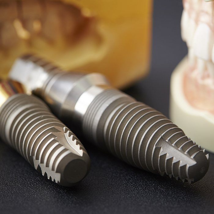 Two dental implant posts and smile model