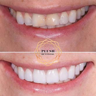 Smile gallery of Frisco dental patient