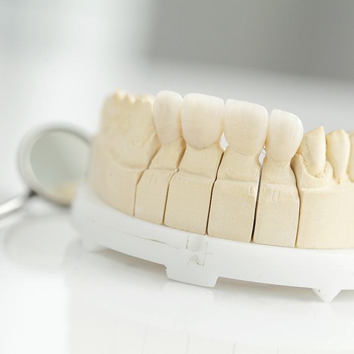 Model smile with dental crown restoration