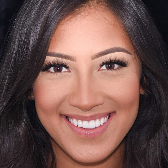 A young woman standing outside during the fall months and smiling after receiving veneers in Frisco