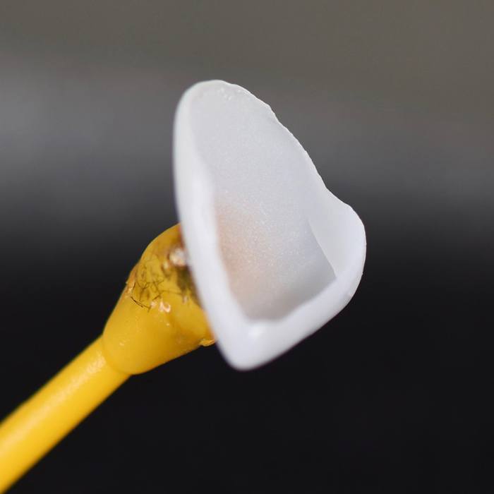 A digital image of a porcelain veneer being placed over the front surface of a tooth along the top arch