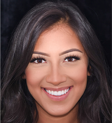 A woman lying in a dentist’s chair and smiling in preparation for receiving her porcelain veneers