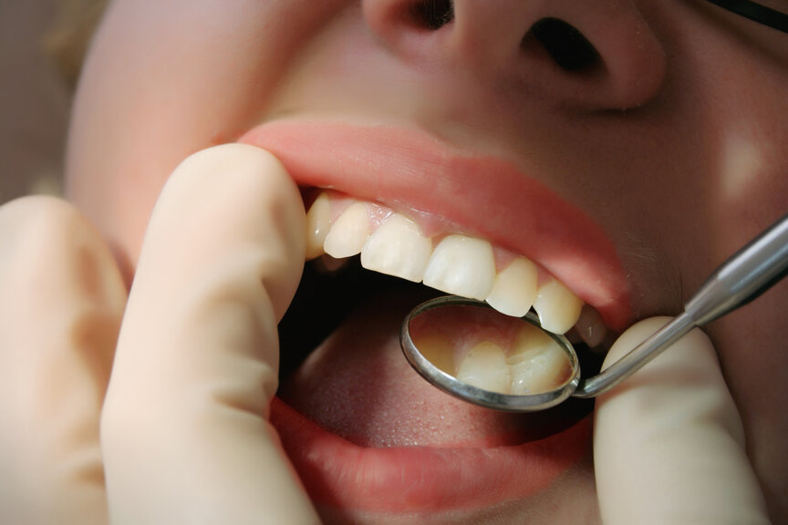 person at dentist for gum disease therapy in Frisco