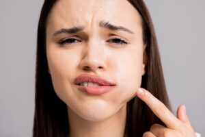 Woman with brown hair pointing to her swollen jaw